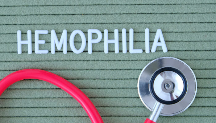 Hemophilia – Early signs and ways to manage the condition