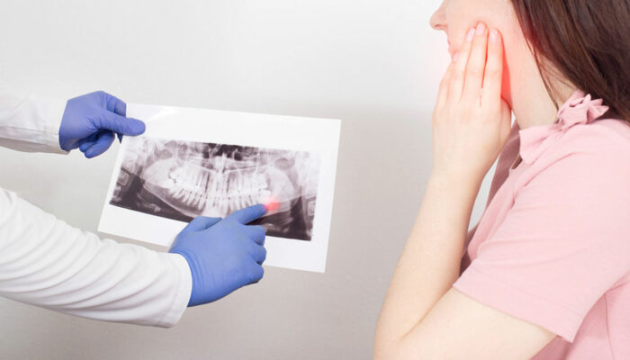 6 adverse effects of implants on teeth